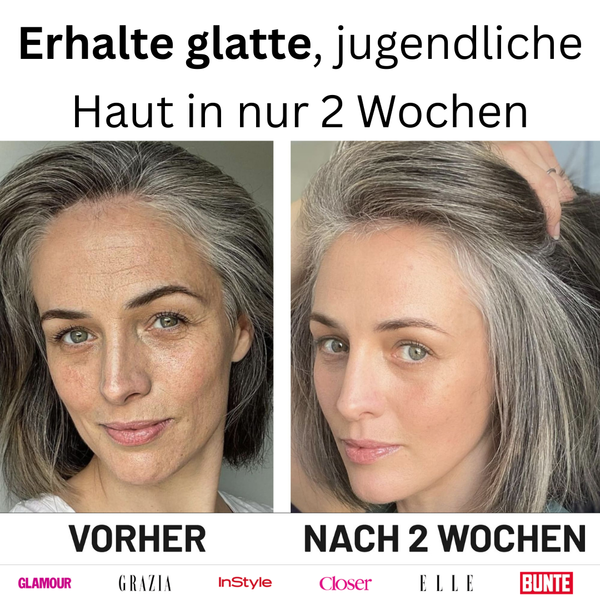 Miski Micro Infusion System