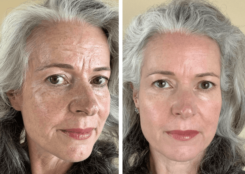 Amata Synergie System IT