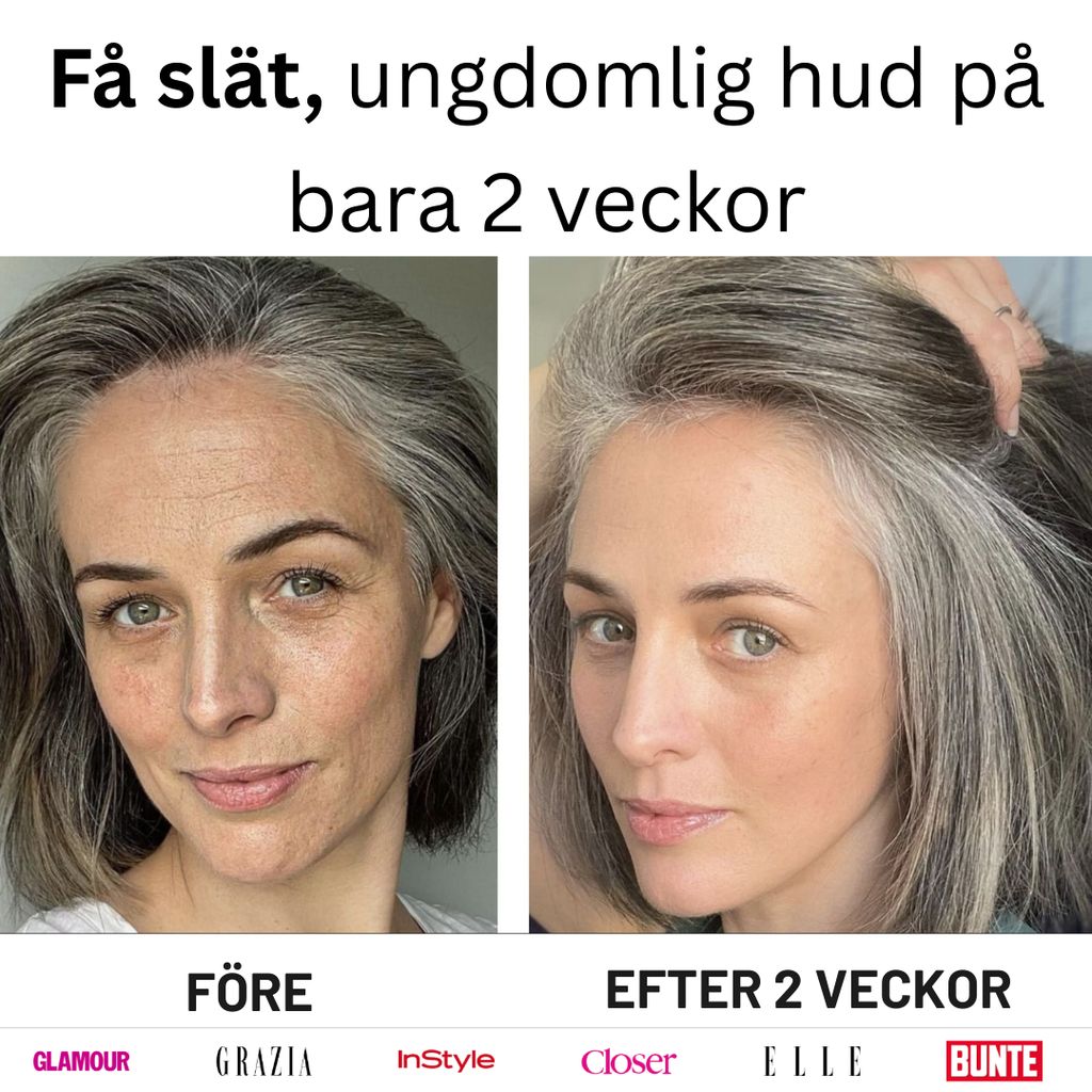 Mikro-Infusionssystem SE (BOGO)