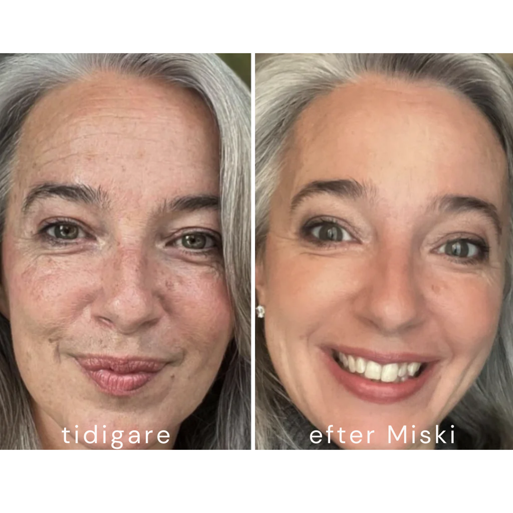 Mikro-Infusionssystem SE (BOGO)